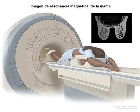 Equipo de Resonancia Magnética
